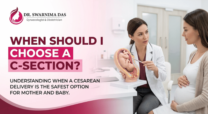 when should I choose a c section procedure